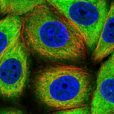 Immunocytochemistry/Immunofluorescence: CSDE1 Antibody [NBP2-38665] - Staining of human cell line MCF7 shows localization to cytosol. Antibody staining is shown in green.