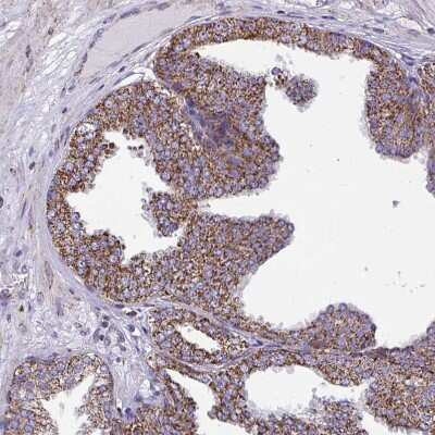 Immunohistochemistry-Paraffin: CSDE1 Antibody [NBP2-38665] - Staining of human prostate shows strong granular positivity in cytoplasm in glandular cells.