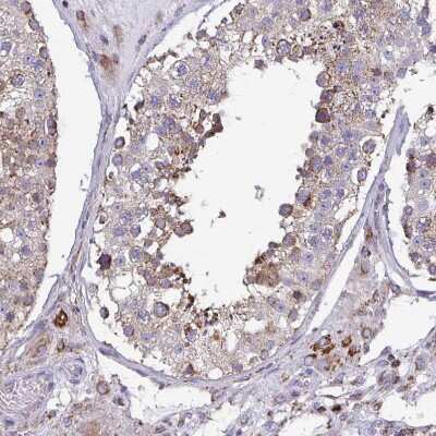 Immunohistochemistry-Paraffin: CSDE1 Antibody [NBP2-38665] - Staining of human testis shows moderate granular positivity in cytoplasm in cells in seminiferous ducts.