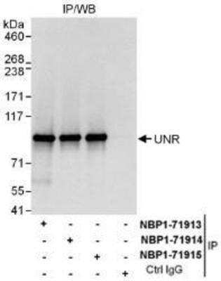 Immunoprecipitation: CSDE1 Antibody [NBP1-71914] - Whole cell lysate (1 mg for IP, 20% of IP loaded) from HeLa cells. Affinity purified rabbit anti-UNR antibody used for IP at 6 mcg/mg lysate.  UNR was also immunoprecipitated by rabbit anti-UNR antibodies NBP1-71913 and NBP1-71915, which recognize other epitopes.