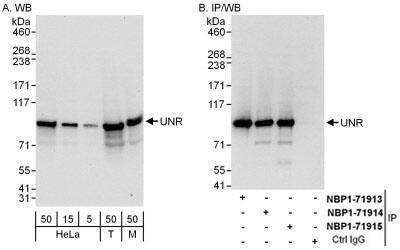 <b>Independent Antibodies Validation and Biological Strategies Validation.</b>Western Blot: CSDE1 Antibody [NBP1-71915] - Whole cell lysate from HeLa (5, 15 and 50 mcg for WB; 1 mg for IP, 20% of IP loaded), 293T (T; 50 mcg), and mouse NIH3T3 (M; 50 mcg) cells.   Antibodies: Affinity purified rabbit anti-UNR antibody used for WB at 0.04 mcg/ml (A) and 0.4 mcg/ml (B) and used for IP at 6 mcg/mg lysate.  UNR was also immunoprecipitated by rabbit anti-UNR antibodies NBP1-71913 and NBP1-71914, which recognize upstream epitopes.