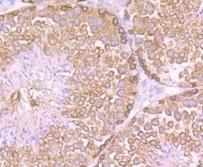Immunohistochemistry-Paraffin: CSE1L/CAS/Exportin-2 Antibody (JU34-33) [NBP2-75451] - Analysis of paraffin-embedded mouse testis tissue using anti-Cellular Apoptosis Susceptibility antibody. Counter stained with hematoxylin.