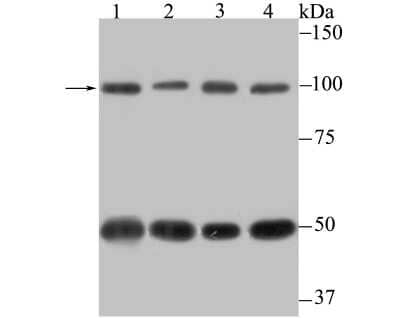 Western Blot: CSE1L/CAS/Exportin-2 Antibody (JU34-33) [NBP2-75451] - Analysis of Cellular Apoptosis Susceptibility on different lysates using anti-Cellular Apoptosis Susceptibility antibody at 1/500 dilution.Positive control:Lane 1: Mouse testis   Lane 2: SiHaLane 3: SK-BR-3        Lane 4: PC-3M