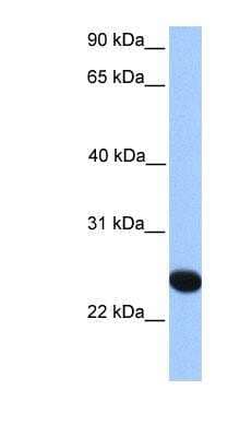 Western Blot CSGLCAT Antibody - BSA Free