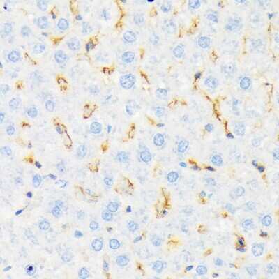 Immunohistochemistry-Paraffin: CSK Antibody (1A2F5) [NBP3-15297] - Immunohistochemistry of paraffin-embedded rat liver using CSK Rabbit mAb (NBP3-15297) at dilution of 1:100 (40x lens).Perform microwave antigen retrieval with 10 mM Tris/EDTA buffer pH 9.0 before commencing with IHC staining protocol.