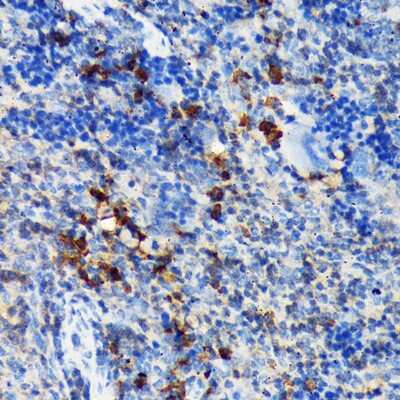 Immunohistochemistry-Paraffin: CSK Antibody (1A2F5) [NBP3-15297] - Immunohistochemistry of paraffin-embedded mouse spleen using CSK Rabbit mAb (NBP3-15297) at dilution of 1:100 (40x lens).Perform microwave antigen retrieval with 10 mM Tris/EDTA buffer pH 9.0 before commencing with IHC staining protocol.