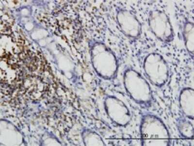 Immunohistochemistry-Paraffin: CSK Antibody (3A3) [H00001445-M01] - Analysis of monoclonal antibody to CSK on formalin-fixed paraffin-embedded human colon. Antibody concentration 1 ug/ml.