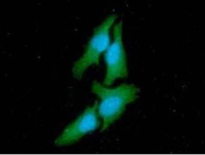 Immunocytochemistry/Immunofluorescence: CSK Antibody (7C6) [NBP2-59500] - Analysis of CSK in HeLa cells line, stained with DAPI (Blue) for nucleus staining and monoclonal anti-human CSK antibody (1:100) with goat anti-mouse IgG-Alexa fluor 488 conjugate (Green)