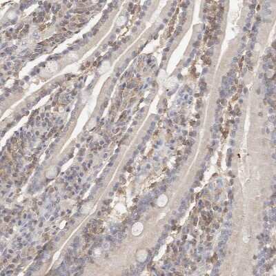 Immunohistochemistry-Paraffin: CSK Antibody [NBP1-85951] - Staining of human duodenum shows weak to moderate cytoplasmic positivity in lymphoid cells.