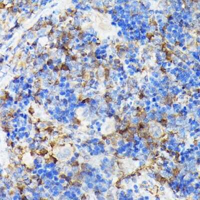 Immunohistochemistry-Paraffin: CSK Antibody [NBP2-92944] - Immunohistochemistry of paraffin-embedded rat spleen using [KO Validated] CSK Rabbit pAb (NBP2-92944) at dilution of 1:100 (40x lens). Perform high pressure antigen retrieval with 10 mM citrate buffer pH 6.0 before commencing with IHC staining protocol.