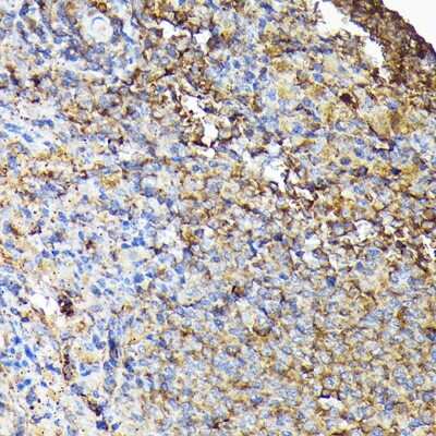 Immunohistochemistry-Paraffin: CSK Antibody [NBP2-92944] - Immunohistochemistry of paraffin-embedded mouse spleen using [KO Validated] CSK Rabbit pAb (NBP2-92944) at dilution of 1:100 (40x lens). Perform high pressure antigen retrieval with 10 mM citrate buffer pH 6.0 before commencing with IHC staining protocol.