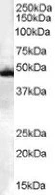 Western Blot: CSK Antibody [NB100-808] - Staining of Jurkat lysate (35 ug protein in RIPA buffer). Antibody at 0.1 ug/mL. Detected by chemiluminescence.