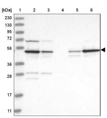 Western Blot: CSK Antibody [NBP1-85951] - Lane 1: Marker  [kDa] 230, 130, 95, 72, 56, 36, 28, 17, 11.  Lane 2: Human cell line RT-4.  Lane 3: Human cell line U-251MG sp.  Lane 4: Human plasma (IgG/HSA depleted).  Lane 5: Human liver tissue.  Lane 6: Human tonsil tissue