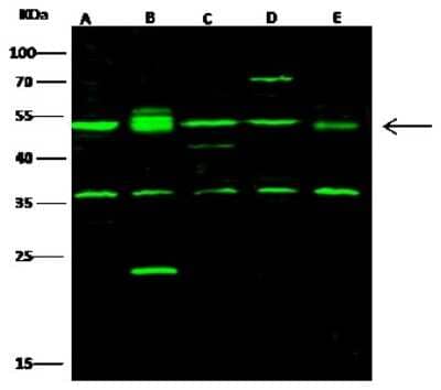 Western Blot: CSK Antibody [NBP2-98358] - Anti-CSK rabbit polyclonal antibody at 1:500 dilution. Lane A: Jurkat Whole Cell Lysate. Lane B: Mouse spleen tissue Lysate. Lane C: NIH-3T3 Whole Cell Lysate. Lysates/proteins at 30 ug per lane. Secondary Goat Anti-Rabbit IgG H&L (Dylight 800) at 1/10000 dilution. Developed using the Odyssey technique. Performed under reducing conditions. Predicted band size: 51 kDa. Observed band size: 51 kDa (We are unsure as to the identity of these extra bands).