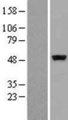 Western Blot: CSK Overexpression Lysate (Adult Normal) [NBP2-09427] Left-Empty vector transfected control cell lysate (HEK293 cell lysate); Right -Over-expression Lysate for CSK.