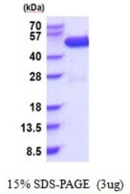 SDS-Page: Recombinant Human CSK Protein [NBP2-51853] - 15% SDS Page (3 ug)