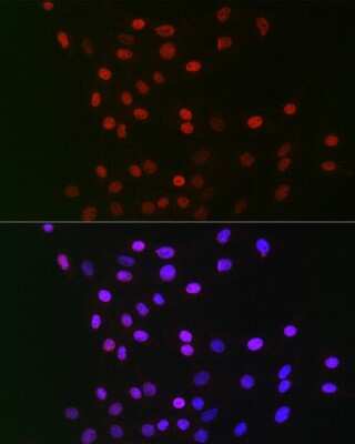 Immunocytochemistry/ Immunofluorescence CSN1 Antibody - BSA Free