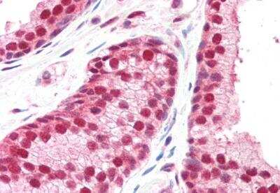 Immunohistochemistry-Paraffin: CSN1 Antibody [NB100-1237] - Staining of paraffin embedded Human Prostate. Antibody at 5 ug/mL. Steamed antigen retrieval with citrate buffer pH 6, AP-staining.