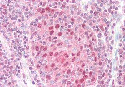 Immunohistochemistry-Paraffin: CSN1 Antibody [NB100-1237] - Staining of paraffin embedded Human Tonsil. Antibody at 5 ug/mL. Steamed antigen retrieval with citrate buffer pH 6, AP-staining.