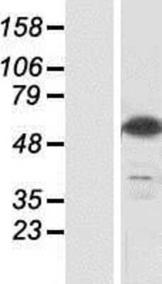 Western Blot: CSN1 Overexpression Lysate (Adult Normal) [NBP2-04487] Left-Empty vector transfected control cell lysate (HEK293 cell lysate); Right -Over-expression Lysate for CSN1.