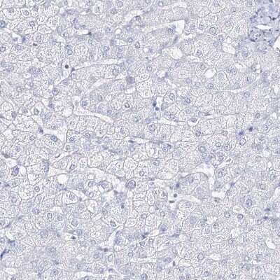 Immunohistochemistry-Paraffin: CSN3 Antibody [NBP1-85436] - Staining of human liver shows no positivity in hepatocytes as expected.