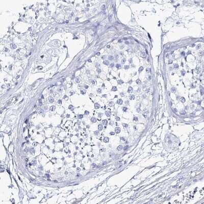 Immunohistochemistry-Paraffin: CSN3 Antibody [NBP1-85436] - Staining of human testis shows no positivity in cells in seminiferous ducts as expected.