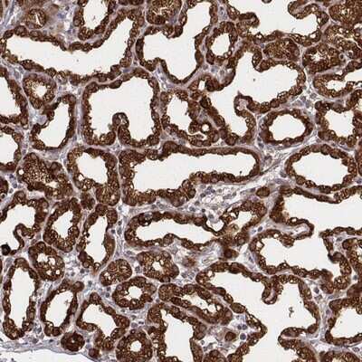 Immunohistochemistry-Paraffin: CSN3 Antibody [NBP2-58781] - Staining of human lactating breast shows strong cytoplasmic positivity in glandular cells.