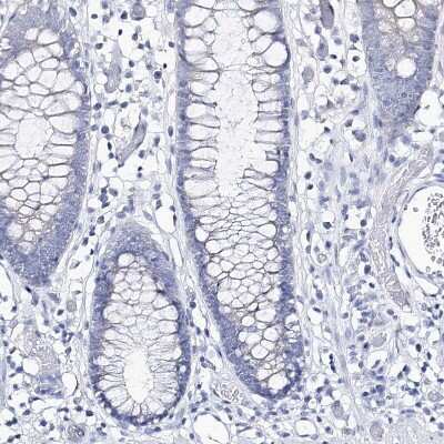 Immunohistochemistry-Paraffin: CSN3 Antibody [NBP2-58781] - Staining of human colon shows no positivity in glandular cells as expected.