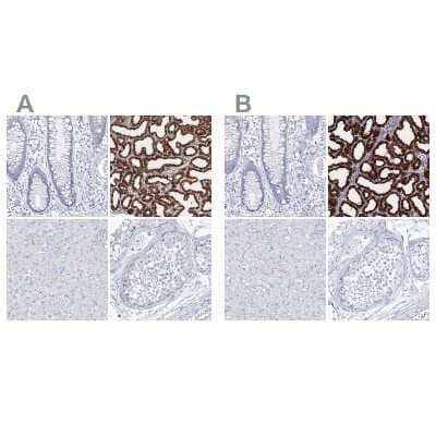 <b>Independent Antibodies Validation. </b>Immunohistochemistry-Paraffin: CSN3 Antibody [NBP2-58781] - Staining of human colon, lactating breast, liver and testis using Anti-CSN3 antibody NBP2-58781 (A) shows similar protein distribution across tissues to independent antibody NBP1-85436 (B).