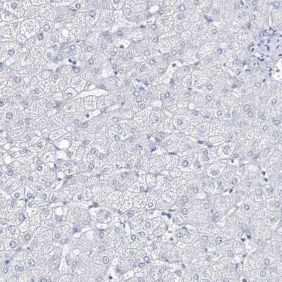 Immunohistochemistry-Paraffin: CSN3 Antibody [NBP2-58781] - Staining of human liver shows no positivity in hepatocytes as expected.