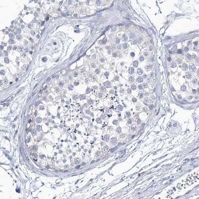 Immunohistochemistry-Paraffin: CSN3 Antibody [NBP2-58781] - Staining of human testis shows no positivity in cells in seminiferous ducts as expected.