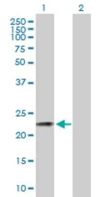 Western Blot: CSN3 Antibody [H00001448-B01P] - Analysis of CSN3 expression in transfected 293T cell line by CSN3 polyclonal antibody.  Lane 1: CSN3 transfected lysate(20.02 KDa). Lane 2: Non-transfected lysate.