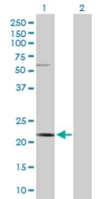 Western Blot: CSN3 Antibody [H00001448-D01P] - Analysis of CSN3 expression in transfected 293T cell line by CSN3 polyclonal antibody.Lane 1: CSN3 transfected lysate(20.20 KDa).Lane 2: Non-transfected lysate.