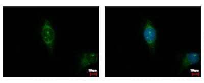 Immunocytochemistry/Immunofluorescence: CSNK1A1L Antibody [NBP2-16020] - Detection of CSNK1A1L protein at cytoplasm by immunofluorescent analysis. Sample: HeLa cells were fixed in iced-cold MeOH for 5 min. Green: CSNK1A1L protein stained by Casein Kinase 1 alpha 1L antibody diluted at 1:500. Blue: Hoechst 33342 staining.