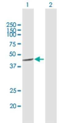 Western Blot: CSNK1A1L Antibody [H00122011-B03P] - Analysis of CSNK1A1L expression in transfected 293T cell line. Lane 1: CSNK1A1L transfected lysate (39.10 KDa). Lane 2: Non-transfected lysate.