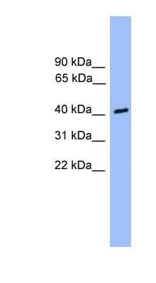 Western Blot: CSNK1A1L Antibody [NBP1-79514] - 721_B cell lysate, concentration 0.2-1 ug/ml.