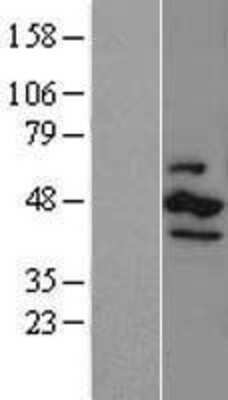 Western Blot Casein Kinase 1 epsilon Overexpression Lysate