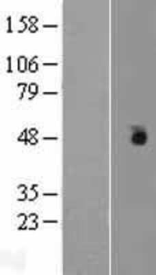 Western Blot Casein Kinase 1 gamma Overexpression Lysate