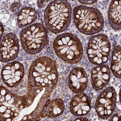 Immunohistochemistry-Paraffin: CSPG4P5 Antibody [NBP1-94154] Staining of human colon shows strong cytoplasmic positivity in glandular cells.