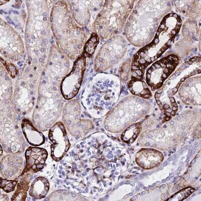 Immunohistochemistry-Paraffin: CSRP2 Antibody [NBP2-13879] - Staining of human Kidney shows strong cytoplasmic positivity in cells in distal tubules.
