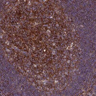 Immunohistochemistry-Paraffin: CSRP2 Antibody [NBP2-13879] - Staining of human lymphoid tissues shows cytoplasmic positivity in germinal center cells.