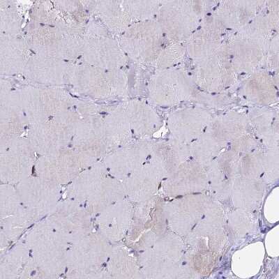 Immunohistochemistry-Paraffin: CSRP2 Antibody [NBP2-13879] - Staining of human skeletal muscle shows negative to very weak positivity in myocytes.