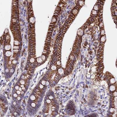 Immunohistochemistry-Paraffin: CSRP2 Antibody [NBP2-13879] - Staining of human upper gastrointestinal shows strong membranous positivity in glandular cells.