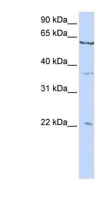 Western Blot: CSRP2 Antibody [NBP1-80293] - HepG2 cell lysate, concentration 0.2-1 ug/ml.