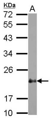 Western Blot: CSRP2 Antibody [NBP2-16021] - Sample (30 ug of whole cell lysate) A: HeLa 12% SDS PAGE gel, diluted at 1:1000.