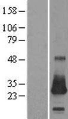 Western Blot: CSRP2 Overexpression Lysate (Adult Normal) [NBL1-09540] Left-Empty vector transfected control cell lysate (HEK293 cell lysate); Right -Over-expression Lysate for CSRP2.