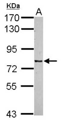 Western Blot CSRP2BP Antibody