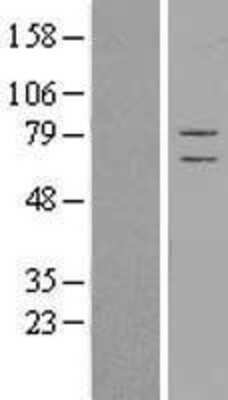Western Blot CSRP2BP Overexpression Lysate
