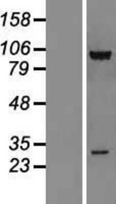Western Blot CSRP2BP Overexpression Lysate