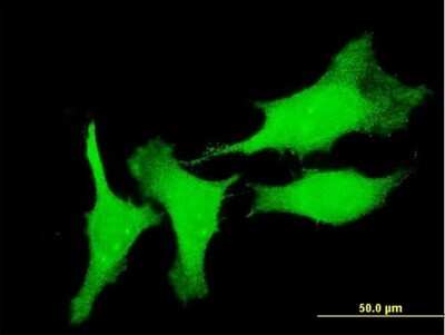 Immunocytochemistry/Immunofluorescence: CSRP3 Antibody (6D2) [H00008048-M03] - Analysis of monoclonal antibody to CSRP3 on HeLa cell. Antibody concentration 10 ug/ml